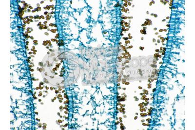 Coprinus sp. Fungo saprofita. Lamella. Sezione longitudinale. 250X