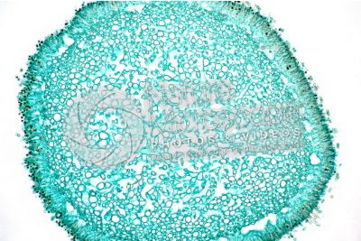 Hydnum sp. Fungo. Aculeo. Sezione trasversale. 250X