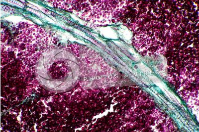 Ustilago avenae. Carbone nudo dell'avena. Fungo parassita. Sezione longitudinale. 500X