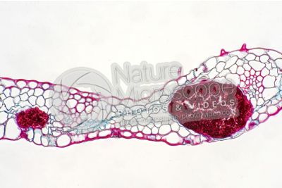 Ustilago tritici. Carbone del frumento. Fungo parassita. Sezione trasversale. 250X