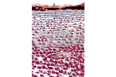 Solanum tuberosum. Patata. Tubero. Amido. 64X