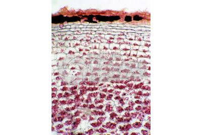 Solanum tuberosum. Patata. Tubero. Amido. 125X