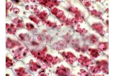 Solanum tuberosum. Patata. Tubero. Amido. 250X