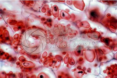 Solanum tuberosum. Patata. Tubero. Amido. 250X