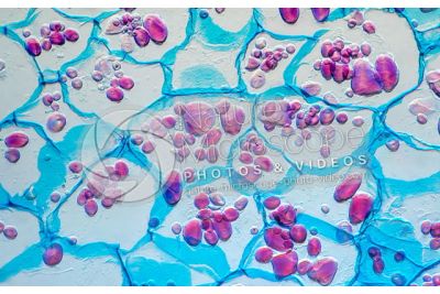 Solanum tuberosum. Patata. Tubero. Amido. 250X