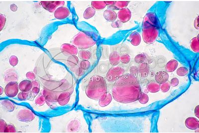 Solanum tuberosum. Patata. Tubero. Amido. 500X