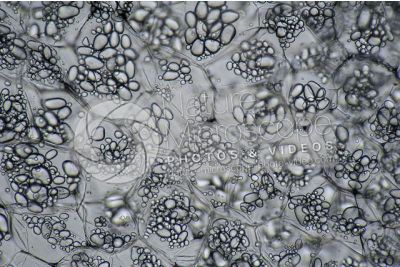 Solanum tuberosum. Patata. Tubero. Amido. 125X
