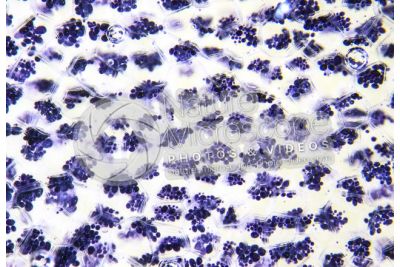 Solanum tuberosum. Patata. Tubero. Amido. Colorazione con tintura di iodio. 64X