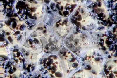 Solanum tuberosum. Patata. Tubero. Amido. Colorazione con tintura di iodio. 250X