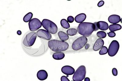Solanum tuberosum. Patata. Tubero. Amido. Colorazione con tintura di iodio. 250X