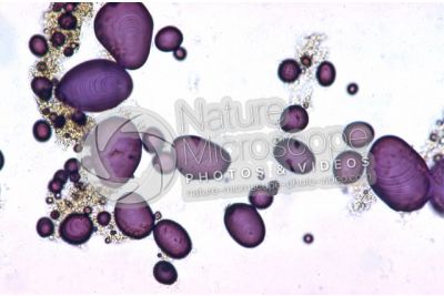 Solanum tuberosum. Patata. Tubero. Amido. Colorazione con tintura di iodio. 250X