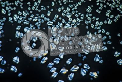 Solanum tuberosum. Patata. Tubero. Amido. Luce polarizzata. 125X