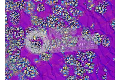 Solanum tuberosum. Patata. Tubero. Amido. Luce polarizzata. 125X