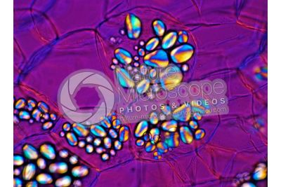 Solanum tuberosum. Patata. Tubero. Amido. Luce polarizzata. 250X