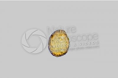 Ulmus minor. Field elm. Pollen. 1000X