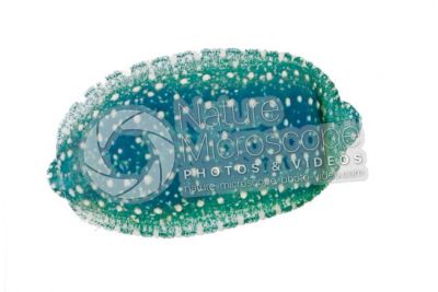 Hemiclepsis marginata. Leech