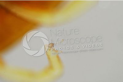 Argas reflexus. Pigeon tick. Ventral view. 20X