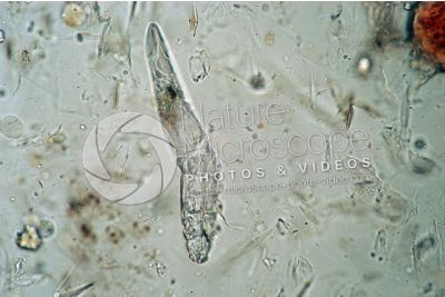 Demodex canis. Demodectic mange. 100X