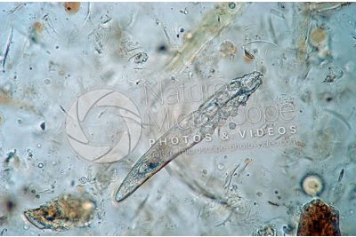 Demodex canis. Demodectic mange. 100X