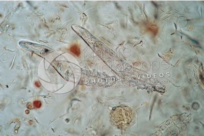 Demodex canis. Demodectic mange. 100X