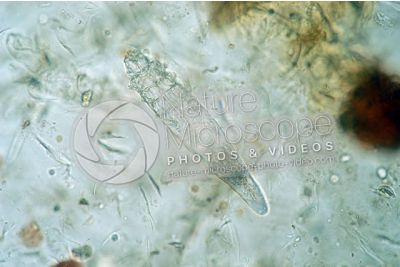 Demodex canis. Demodectic mange. 100X