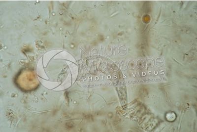 Demodex canis. Demodectic mange. 100X