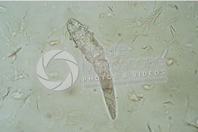 Demodex canis. Demodectic mange. 100X