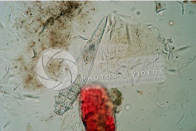 Demodex canis. Demodectic mange. 100X