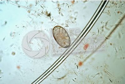 Demodex canis. Demodectic mange. 100X