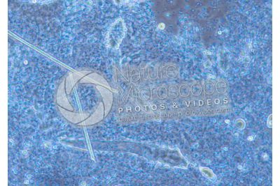 Demodex folliculorum. Demodectic mange. 100X