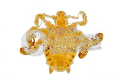 Pthirus pubis. Crab louse. Pediculosis pubis. Dorsal view