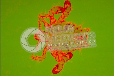 Pthirus pubis. Crab louse. Pediculosis pubis. Dorsal view