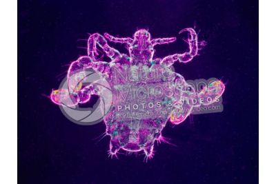 Pthirus pubis. Crab louse. Pediculosis pubis. Dorsal view