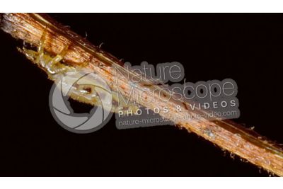 Pediculus humanus capitis. Head louse. Pediculosis. Lateral view