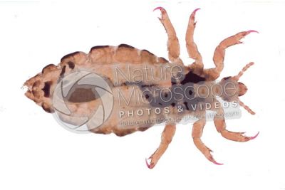 Pediculus humanus capitis. Head louse. Pediculosis. Ventral view