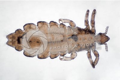 Pediculus humanus capitis. Head louse. Pediculosis. Dorsal view