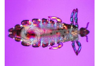 Pediculus humanus capitis. Head louse. Pediculosis. Dorsal view