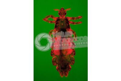 Pediculus humanus capitis. Head louse. Pediculosis. Dorsal view