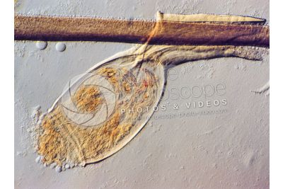 Pediculus humanus capitis. Head louse. Nit. Pediculosis. 100X