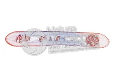 Taenia solium. Tapeworm. Taeniasis. Transverse section. 5X