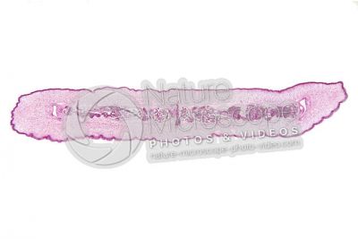 Taenia solium. Tapeworm. Taeniasis. Transverse section. 5X