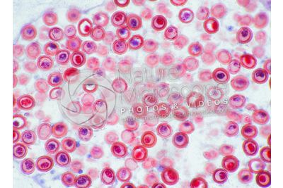 Taenia solium. Tapeworm. Taeniasis. Transverse section. 125X