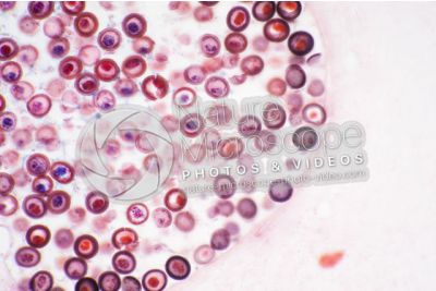 Taenia solium. Tapeworm. Taeniasis. Transverse section. 125X