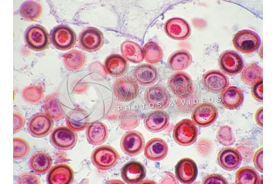 Taenia solium. Tapeworm. Taeniasis. Transverse section. 250X
