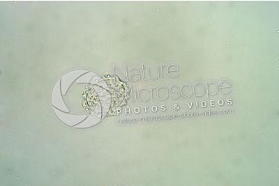 Ascaris lumbricoides. Ascariasis. 250X
