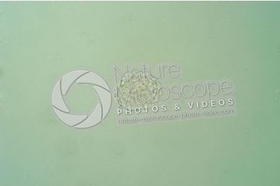 Ascaris lumbricoides. Ascariasis. 250X