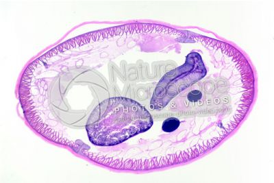 Ascaris megalocephala. Ascariasis. Male. Transverse section. 32X