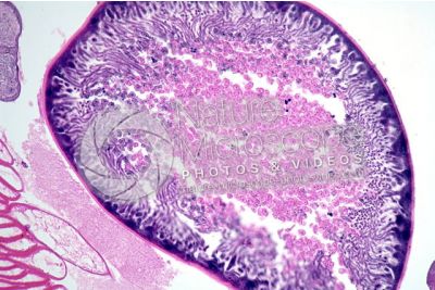 Ascaris megalocephala. Ascariasis. Male. Vas deferens. Transverse section. 125X
