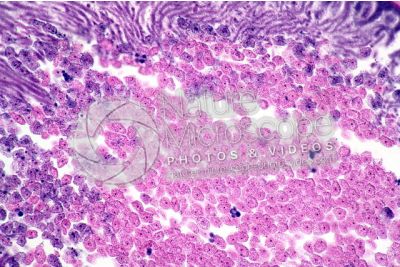 Ascaris megalocephala. Ascariasis. Male. Vas deferens. Transverse section. 250X