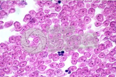 Ascaris megalocephala. Ascariasis. Male. Vas deferens. Transverse section. 500X